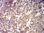 GRIK4 Antibody in Immunohistochemistry (Paraffin) (IHC (P))