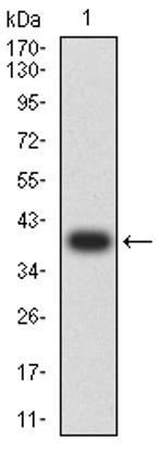 GRIK5 Antibody in Western Blot (WB)