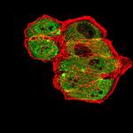 mGluR7 Antibody in Immunocytochemistry (ICC/IF)