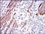 GSTM1 Antibody in Immunohistochemistry (Paraffin) (IHC (P))