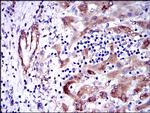 GSTM1 Antibody in Immunohistochemistry (Paraffin) (IHC (P))