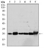 GSTM1 Antibody in Western Blot (WB)