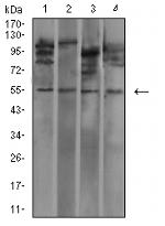 IGHA1 Antibody in Western Blot (WB)