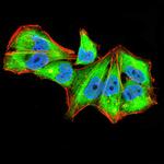 IL1RAPL1 Antibody in Immunocytochemistry (ICC/IF)