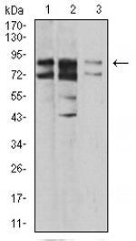 IL1RAPL1 Antibody in Western Blot (WB)