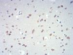 IL-28A Antibody in Immunohistochemistry (Paraffin) (IHC (P))