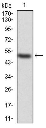 KBTBD8 Antibody in Western Blot (WB)