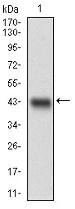 ChREBP Antibody in Western Blot (WB)