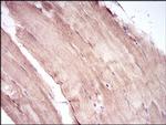 MURF1 Antibody in Immunohistochemistry (Paraffin) (IHC (P))