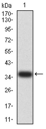 PAK3 Antibody in Western Blot (WB)