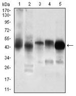 PDK2 Antibody in Western Blot (WB)