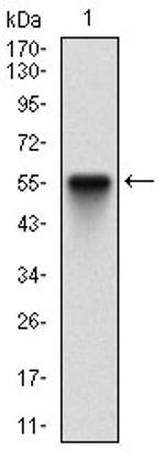 PDK2 Antibody in Western Blot (WB)