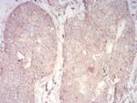 PDPK1 Antibody in Immunohistochemistry (Paraffin) (IHC (P))