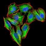 PKN1 Antibody in Immunocytochemistry (ICC/IF)