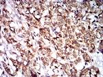 PTPN14 Antibody in Immunohistochemistry (Paraffin) (IHC (P))