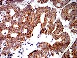 PTPN14 Antibody in Immunohistochemistry (Paraffin) (IHC (P))