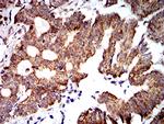 PTPN14 Antibody in Immunohistochemistry (Paraffin) (IHC (P))