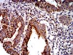 PTPN14 Antibody in Immunohistochemistry (Paraffin) (IHC (P))