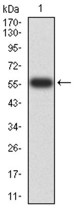 PTPN14 Antibody in Western Blot (WB)