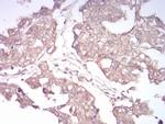 RAB13 Antibody in Immunohistochemistry (Paraffin) (IHC (P))