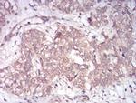 RAB13 Antibody in Immunohistochemistry (Paraffin) (IHC (P))