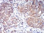 RAB1B Antibody in Immunohistochemistry (Paraffin) (IHC (P))