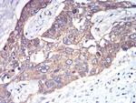 RAB1B Antibody in Immunohistochemistry (Paraffin) (IHC (P))