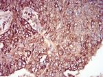 RAB6B Antibody in Immunohistochemistry (Paraffin) (IHC (P))