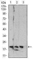 RAB6B Antibody in Western Blot (WB)