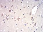 RAD21 Antibody in Immunohistochemistry (Paraffin) (IHC (P))