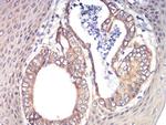 RAD21 Antibody in Immunohistochemistry (Paraffin) (IHC (P))