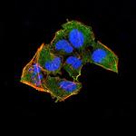 RAD52 Antibody in Immunocytochemistry (ICC/IF)