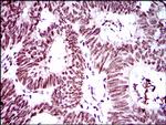 RING1 Antibody in Immunohistochemistry (Paraffin) (IHC (P))