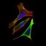 RING1 Antibody in Immunocytochemistry (ICC/IF)