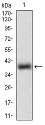 ROR2 Antibody in Western Blot (WB)