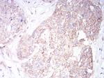 SPHK2 Antibody in Immunohistochemistry (Paraffin) (IHC (P))