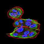 SPHK2 Antibody in Immunocytochemistry (ICC/IF)