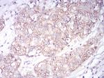 SPHK2 Antibody in Immunohistochemistry (Paraffin) (IHC (P))