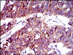 SLC27A2 Antibody in Immunohistochemistry (Paraffin) (IHC (P))