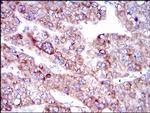 SLC27A5 Antibody in Immunohistochemistry (Paraffin) (IHC (P))