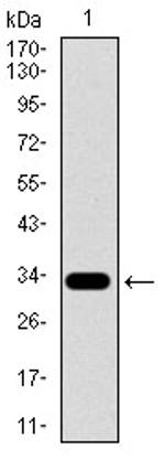 SLC27A5 Antibody in Western Blot (WB)