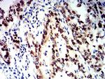 SMARCA1 Antibody in Immunohistochemistry (Paraffin) (IHC (P))