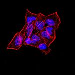 Synapsin 1 Antibody in Immunocytochemistry (ICC/IF)