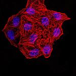 Synapsin 1 Antibody in Immunocytochemistry (ICC/IF)