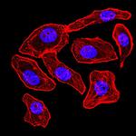 Synapsin 1 Antibody in Immunocytochemistry (ICC/IF)