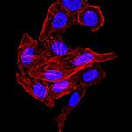 Synapsin 1 Antibody in Immunocytochemistry (ICC/IF)