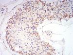 Synapsin 1 Antibody in Immunohistochemistry (Paraffin) (IHC (P))