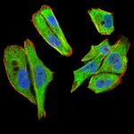 TBCC Antibody in Immunocytochemistry (ICC/IF)