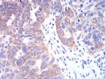 TBCC Antibody in Immunohistochemistry (Paraffin) (IHC (P))