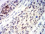 AP2 gamma Antibody in Immunohistochemistry (Paraffin) (IHC (P))